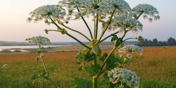giant hogweed burns